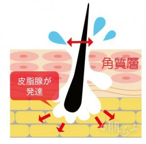 皮脂腺（脂性肌）ロゴ・角質層入り　脂性肌　オイリー肌　皮脂　スキンケア　化粧水