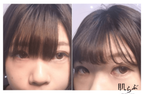 前髪のセルフカット比較