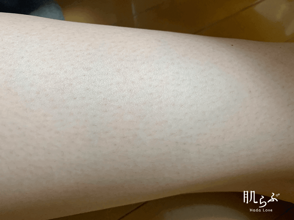 Kmyu除毛クリームを使用する前の肌